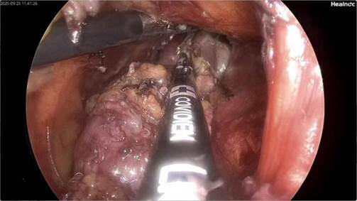 1f866617f39b005ba5a67303baa72d12