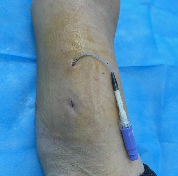 6bbdf6518e4fb20d20cf5ae6f5110487